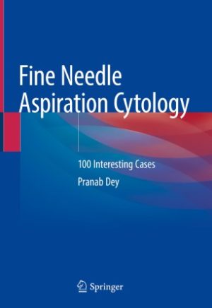 Fine Needle Aspiration Cytology 100 Interesting Cases