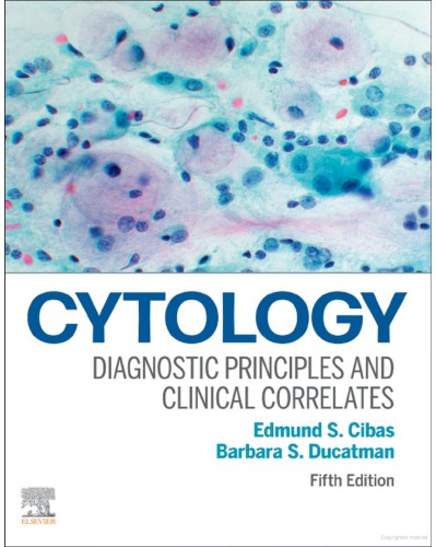 Cytology Diagnostic Principles and Clinical Correlates 5 Edition