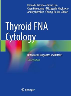 Thyroid FNA Cytology Differential Diagnoses and Pitfalls 3 Edition