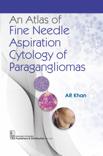 An Atlas of Fine Needle Aspiration Cytology of Paragangliomas 1st Edition