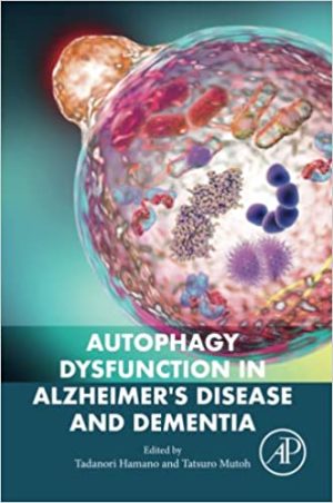 Autophagy Dysfunction in Alzheimers Disease and DementiaAutophagy Dysfunction in Alzheimers Disease and Dementia