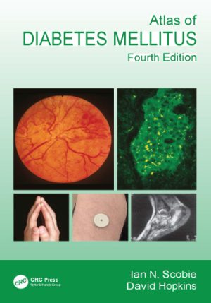 Atlas of Diabetes Mellitus 4th Edition