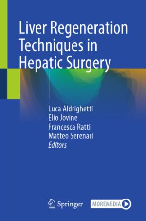 Liver Regeneration Techniques in Hepatic Surgery