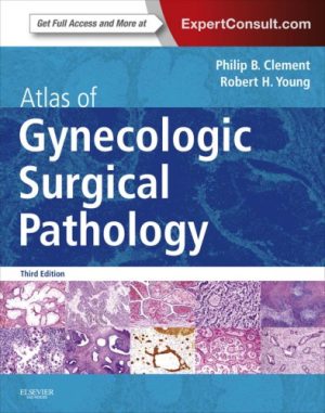 Atlas of Gynecologic Surgical Pathology 3rd Edition