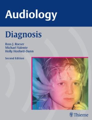 Audiology Diagnosis 2nd Edition