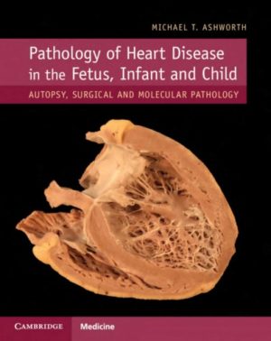 Pathology of Heart Disease in the Fetus Infant and Child Autopsy Surgical and Molecular Pathology